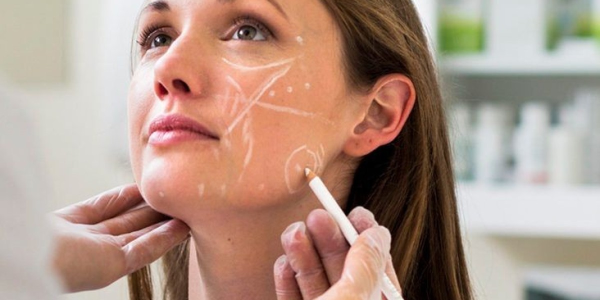 "The Connection Between Cheek Fillers and Lip Enhancements"