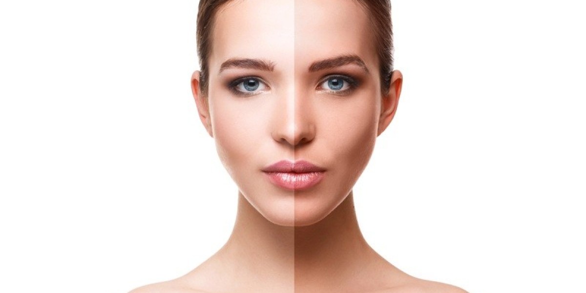 7 Best Tan Removal Treatments Available in Dubai