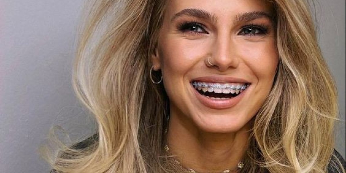 Boost Your Confidence with Metal Braces in Riyadh