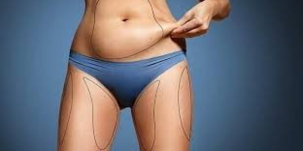 Boost Your Confidence with Fat Transfer in Dubai