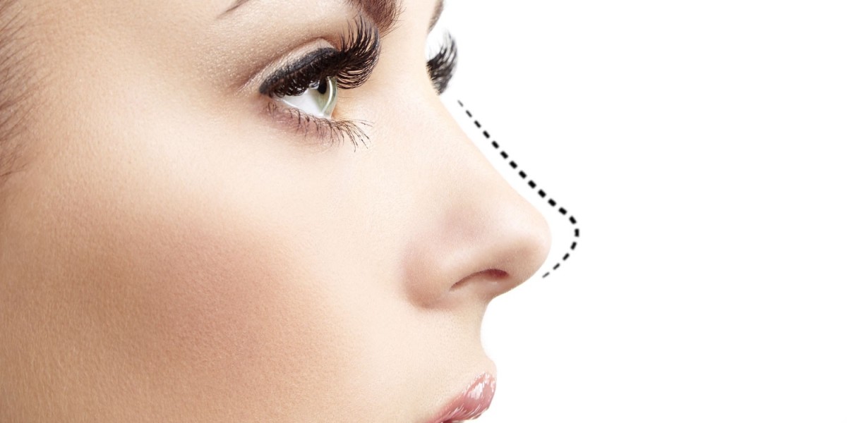 Rhinoplasty for a Middle Eastern Nose: Insights from Dubai Surgeons