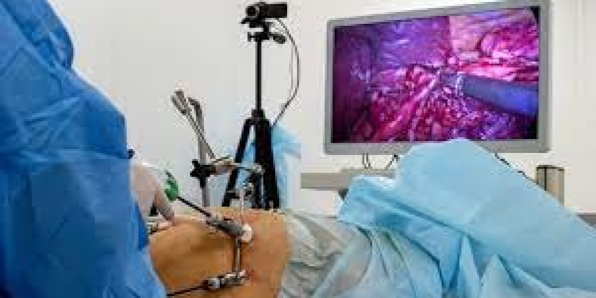 Everything You Need to Know About Laparoscopic Surgery