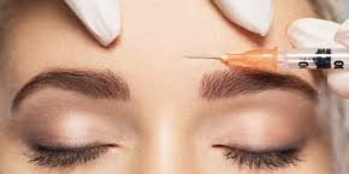 How Long Do the Effects of Underarm Botox Last?
