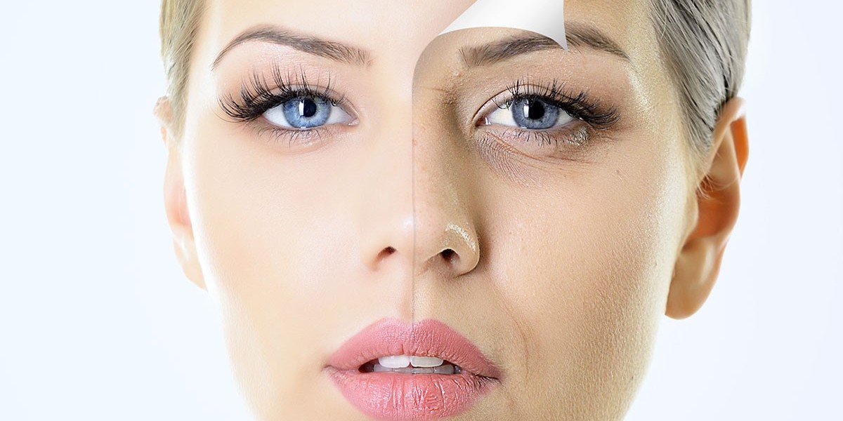 How to Choose the Right Chemical Peel for Your Skin Type in Dubai