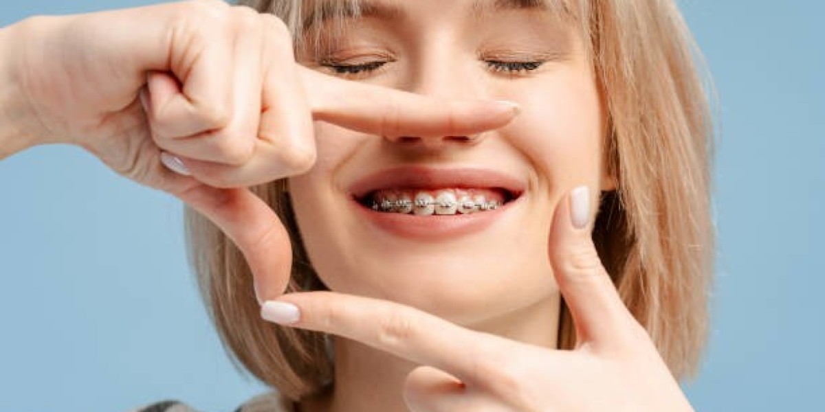 Top Tips for Choosing Orthodontics in Riyadh for Your Family
