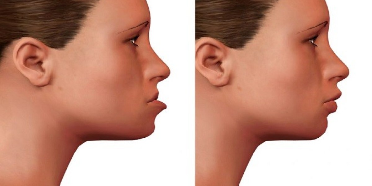 The Latest Trends in Oral and Maxillofacial Surgery Techniques