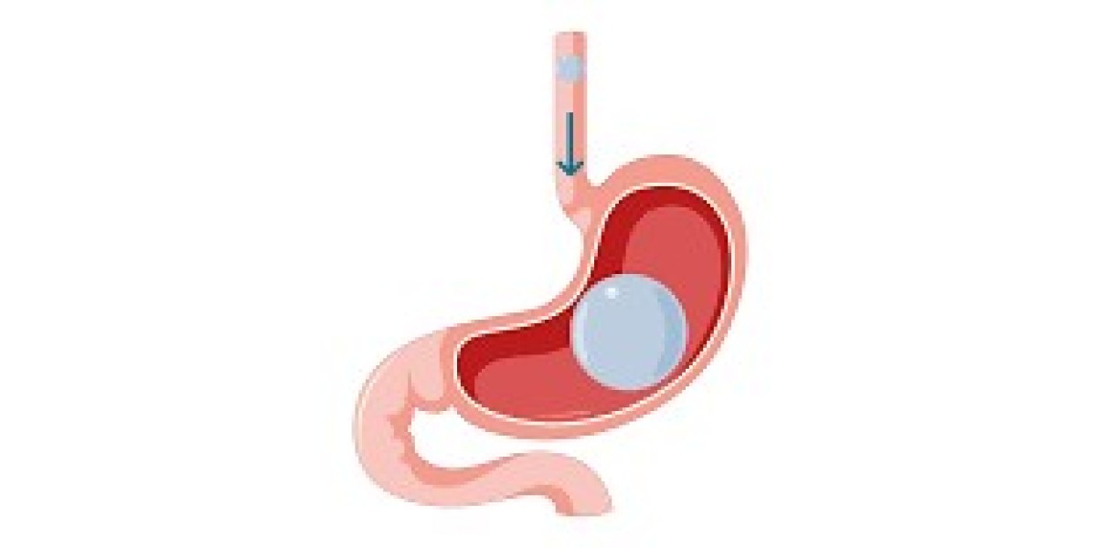Why Endoscopic Intragastric is the New Standard in Bariatric Procedures