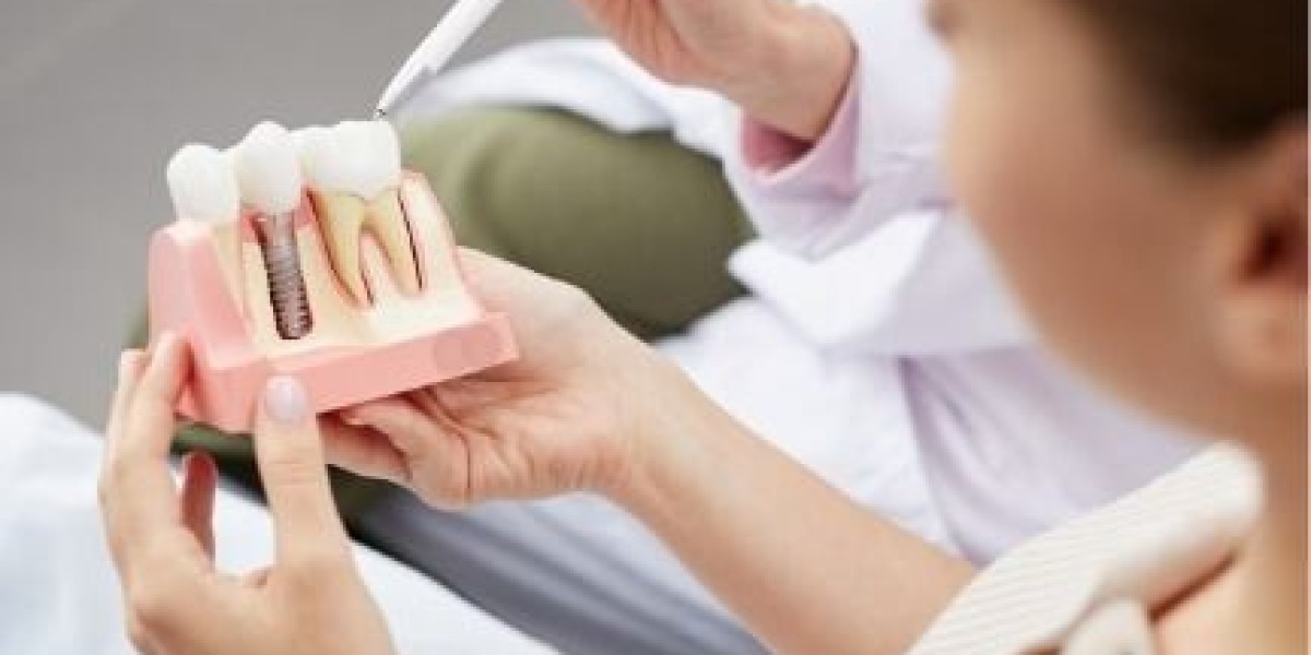 دليل شامل لزراعة الأسنان في دبي: التكاليف والفوائد والمزيد