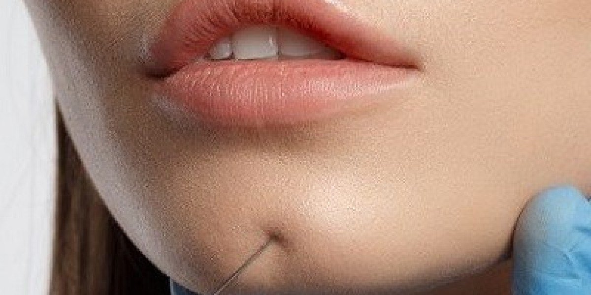 How to Ensure Long-Lasting Results from Your Sculptra Fillers Clinic