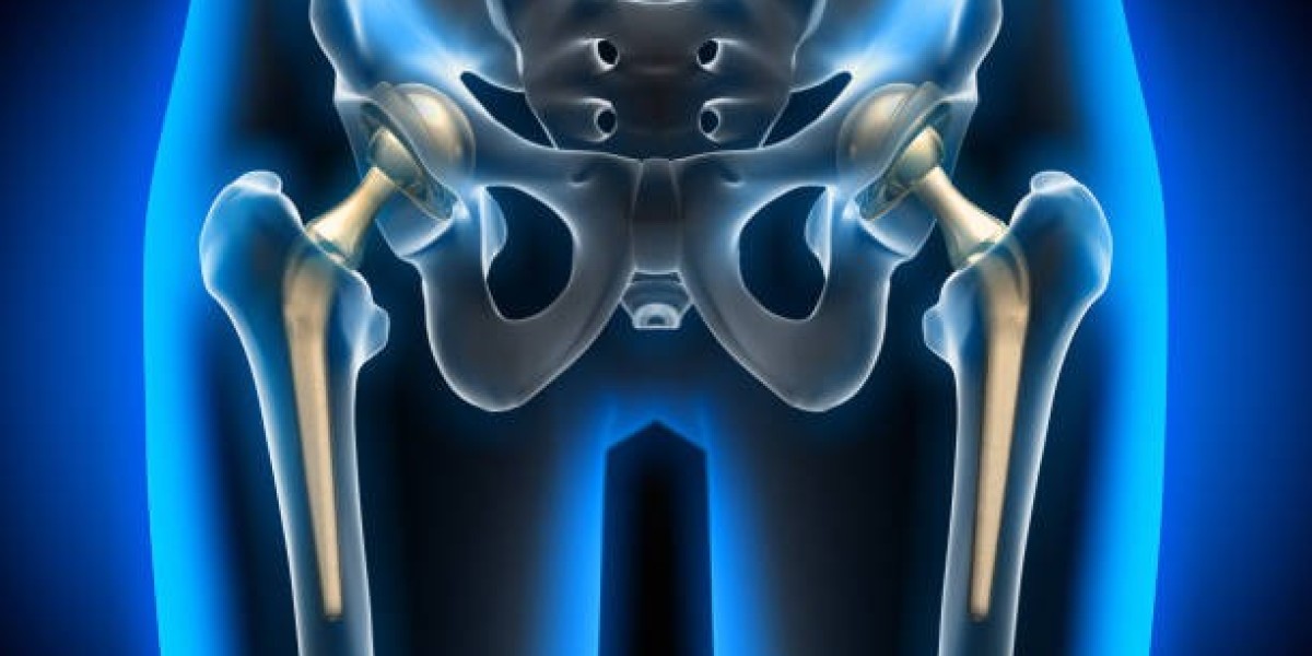 Expert Orthopedic Care: Total Hip Replacement at Gadge Hospital, Nagpur