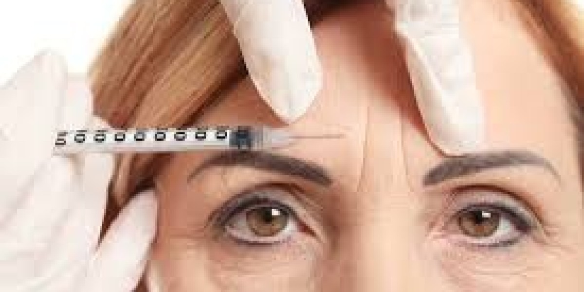 "Botox for Smile Lines: Can It Really Make a Difference?"