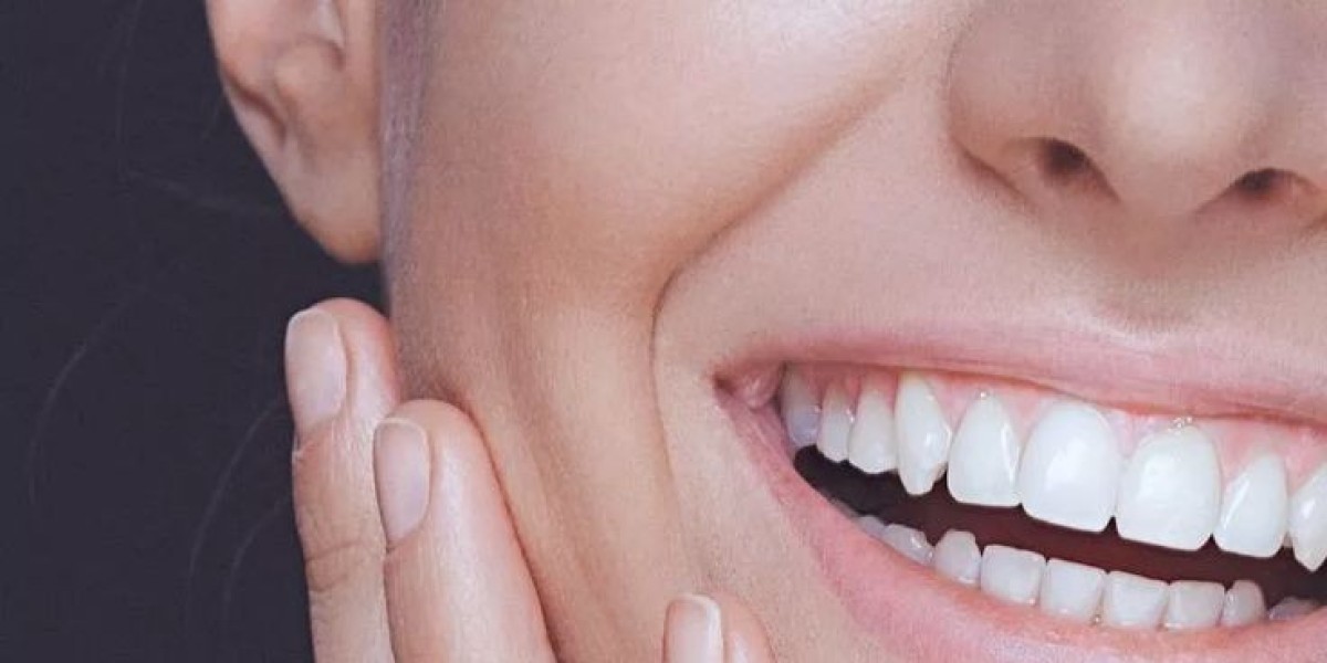 How Home Teeth Whitening in Riyadh Can Boost Your Confidence
