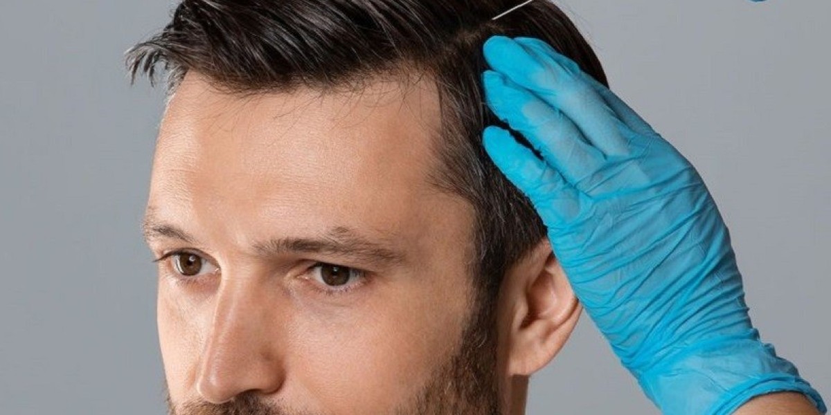 How to Prepare for Your Hair Filler Treatment in Dubai