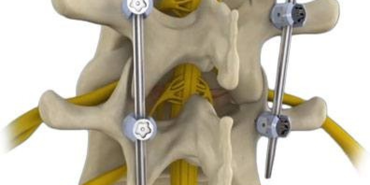 Decompressing the Back: Discovering Comfort