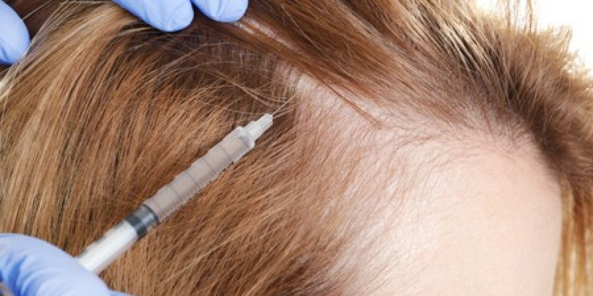 How Dubai’s Cutting-Edge Technology Is Revolutionizing Female Hair Transplants