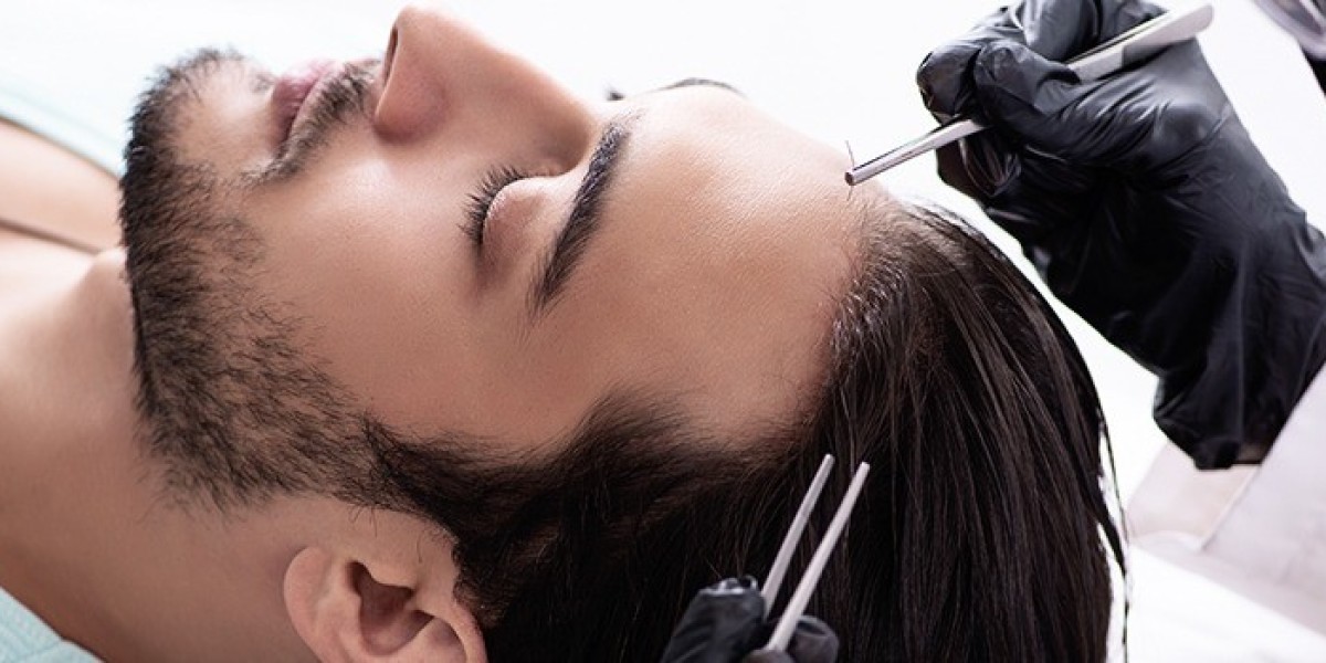 Safe and Effective Botox Treatments in Peshawar