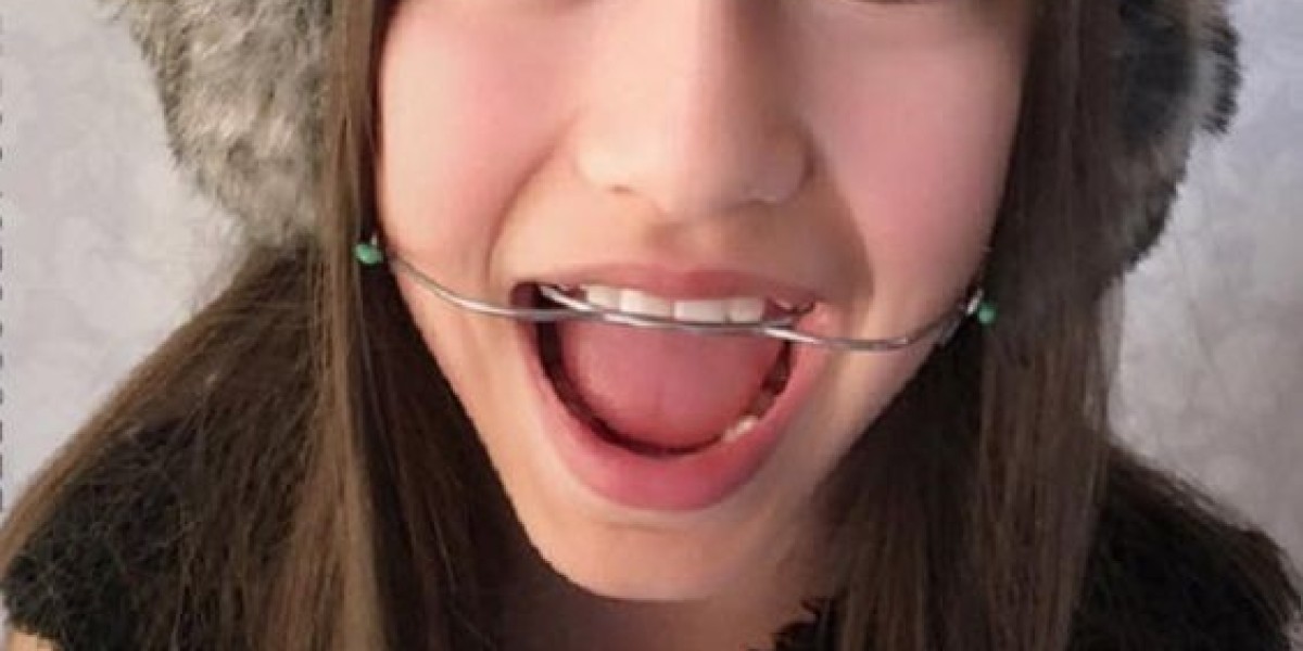 Why Dental Devices in Riyadh Are Essential for Optimal Oral Health
