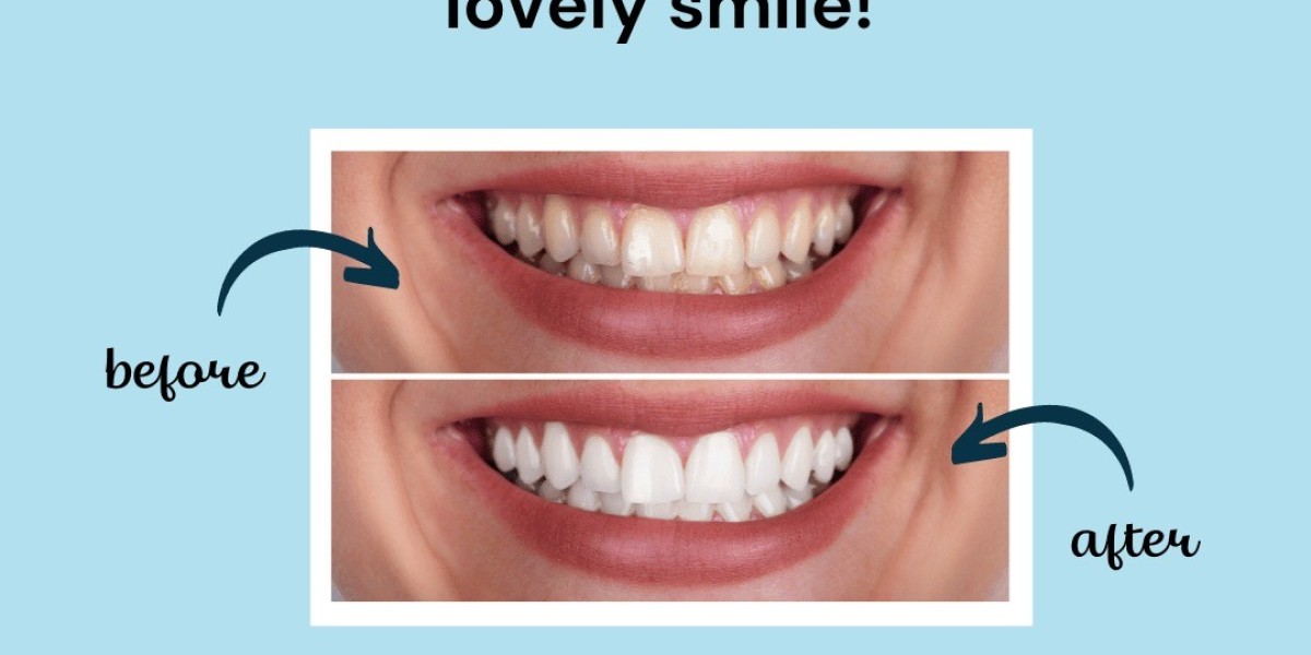 Dentist for Dental Braces in Vasant Kunj: Your Guide to Dental Arche