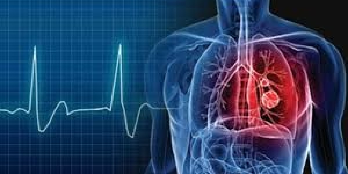 Electrophysiology: The Heart Rhythm Experts of Chennai