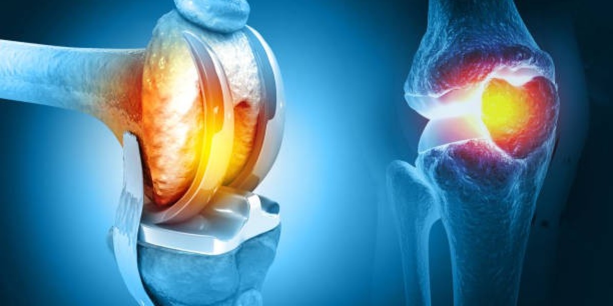 Discover the Best Knee Replacement Surgeons at Gadge Hospital, Nagpur