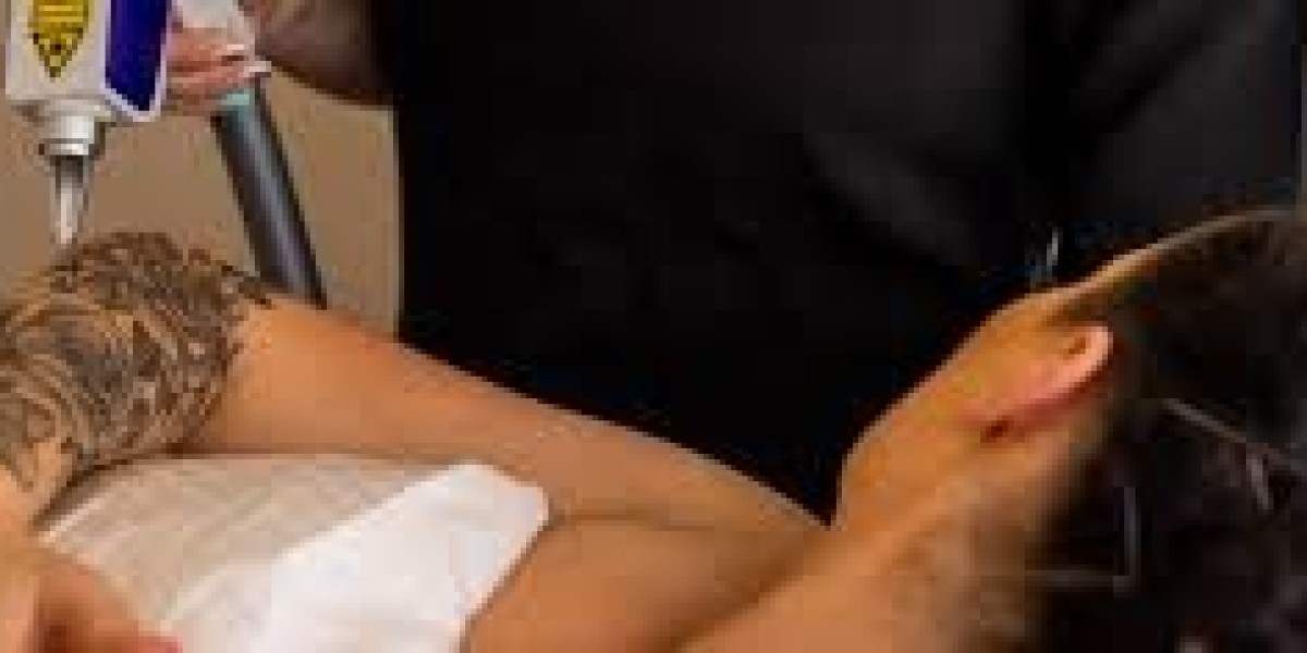Laser Tattoo Removal in Riyadh: What to Expect Before, During, and After