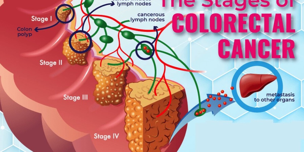 Panitumumab Market Analytical Overview and Growth Opportunities by 2034