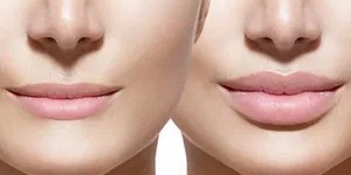 How to Choose the Best Clinic for Lip Reduction Surgery in Islamabad