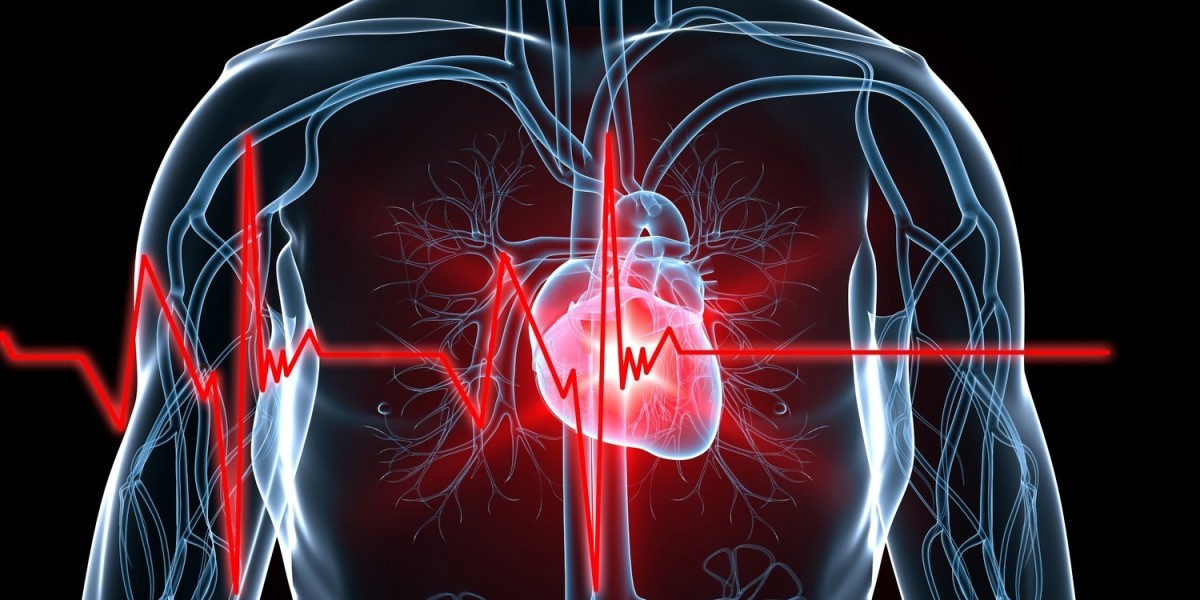 Cardiovascular Devices Market Report by Type, and Global Opportunity Analysis and Industry Forecast, 2024-2034