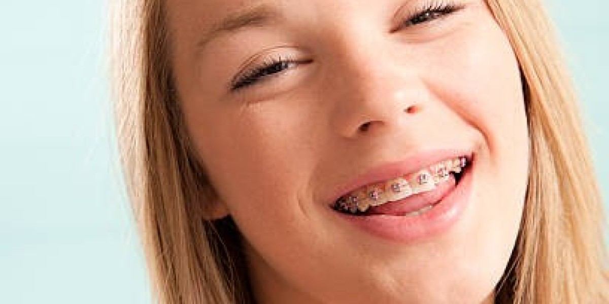 Smile Confidently with Metal Braces in Riyadh
