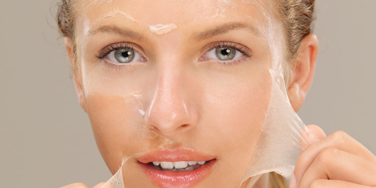 Chemical Peels for Hyperpigmentation: Dubai’s Top Treatments