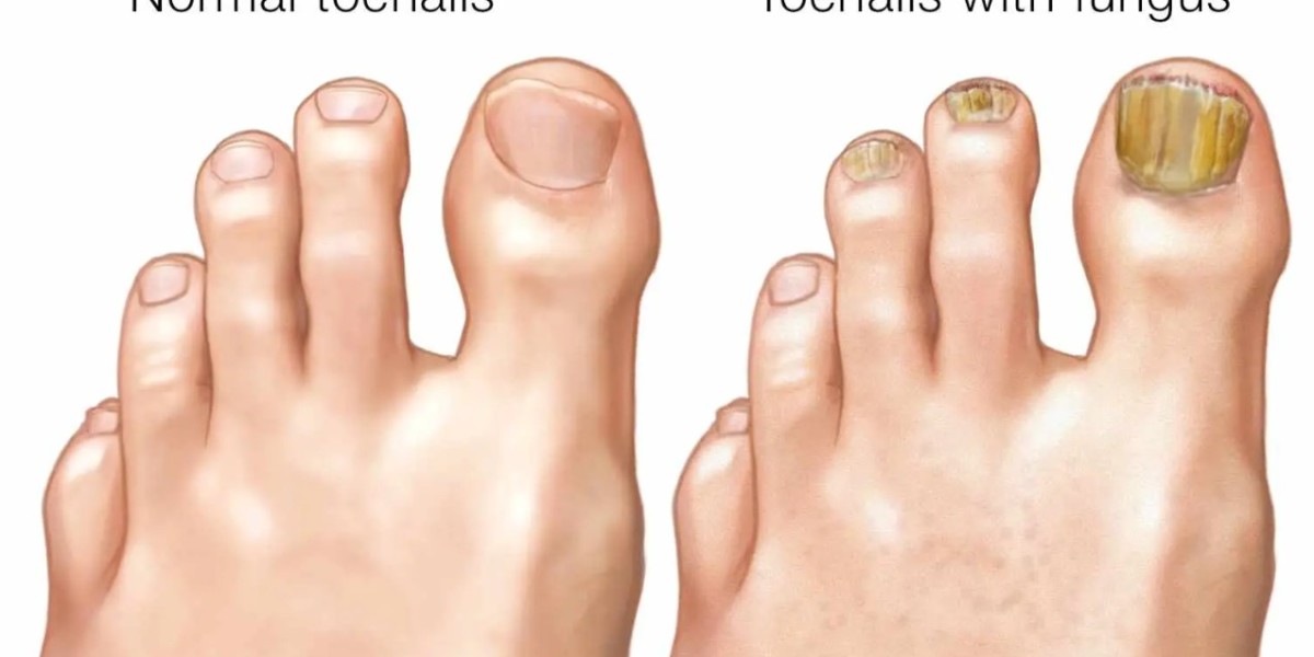 https://www.facebook.com/Get.Cuticara.Fungus.Remover.Antifungal.Ingredients