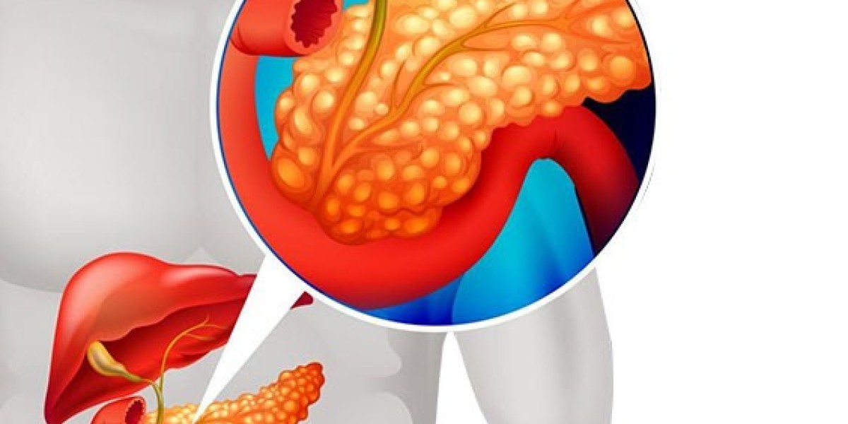 Pancreatic Cancer Market Report (2024-2034): Epidemiology, Industry Trends, Share, Size, Demand