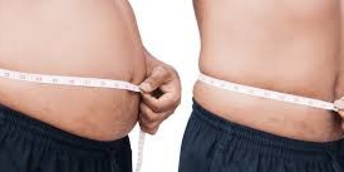Endoscopic Intragastric: A Modern Approach to Overcoming Weight Challenges