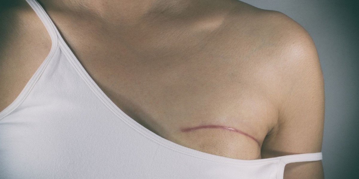 How to Prepare Your Home for Safe Suture Removal