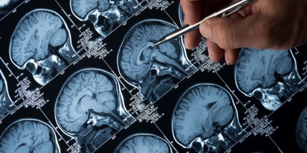 Cancer Tissue Diagnostics Market Growth, Size, Share, Trends, and Forecast 2032