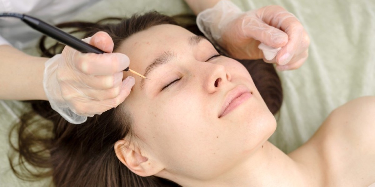 Minimally Invasive Birthmark Removal in Riyadh