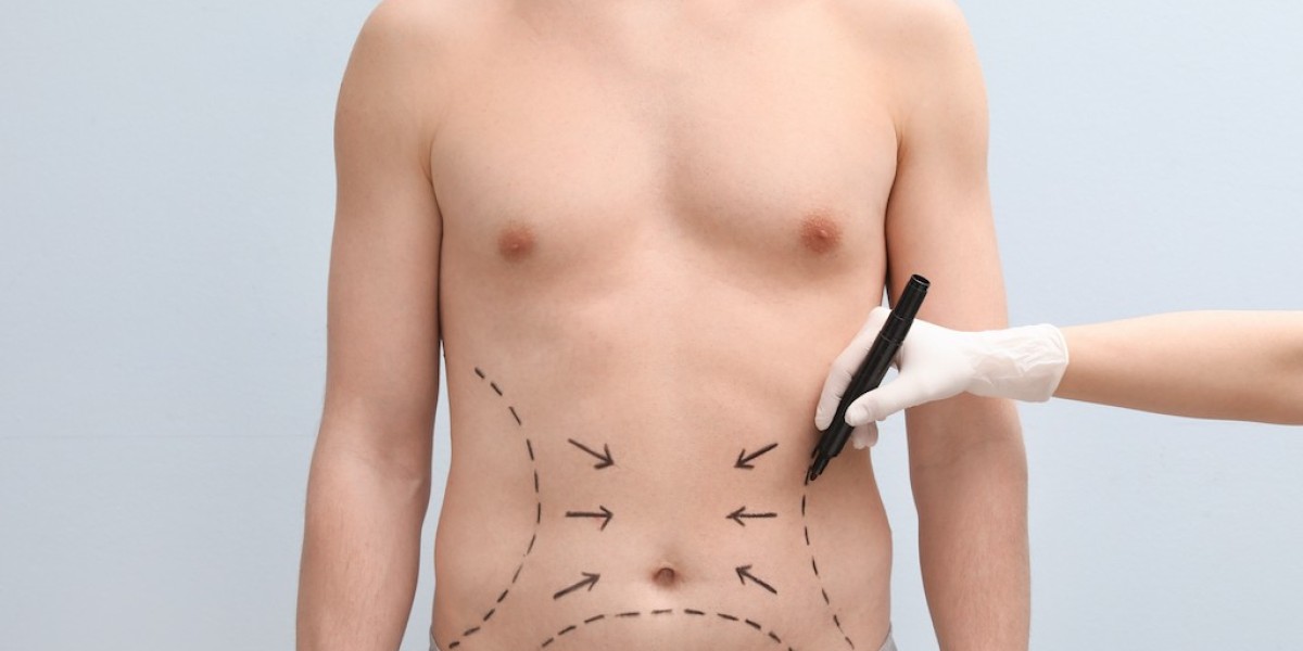 VASER Liposuction in Riyadh: A Closer Look at the Procedure and Recovery