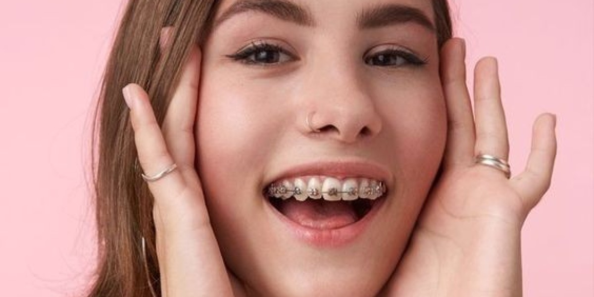 Metal Braces in Riyadh: A Long-Term Investment in Your Smile