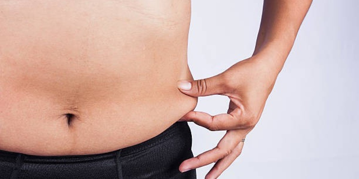 Ideal Candidates for Tummy Tuck