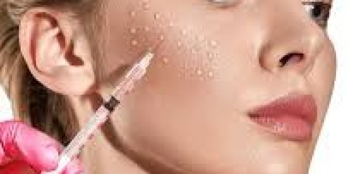 "Enhancing Skin Hydration: Skin Boosters Injections in Dubai"