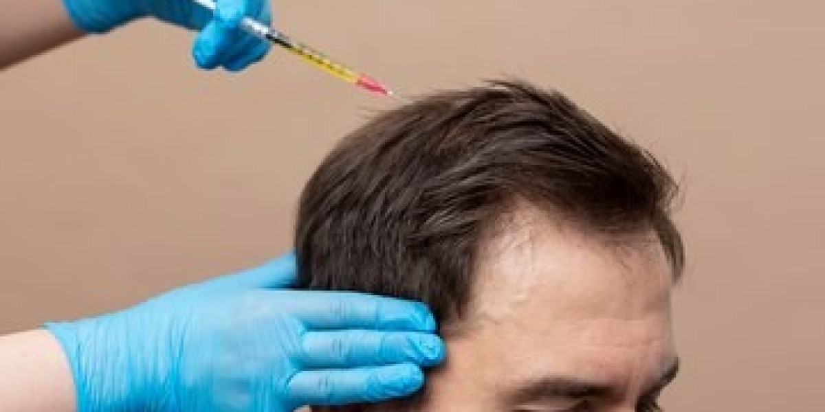 Understanding Hair PRP Treatment: A Comprehensive Guide