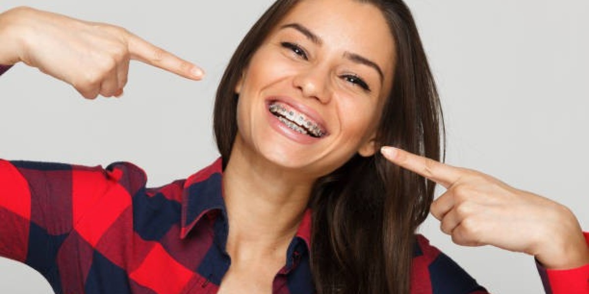 Time-Tested Treatment: Metal Braces in Riyadh for Optimal Results