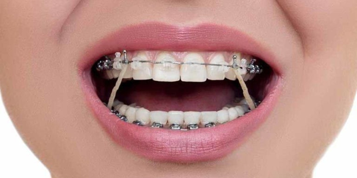Dental Devices in Riyadh: A Comprehensive Overview