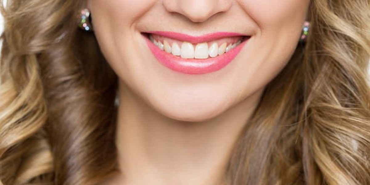 Your Smile, Your Style: Customizing Hollywood Smile Design