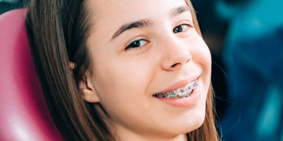 Affordable Options for Metal Braces in Riyadh