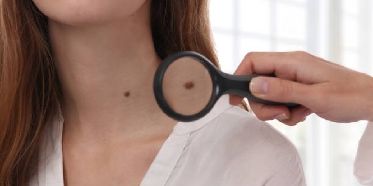 The Science Behind Dermoscopy Mole Evaluation Revealed