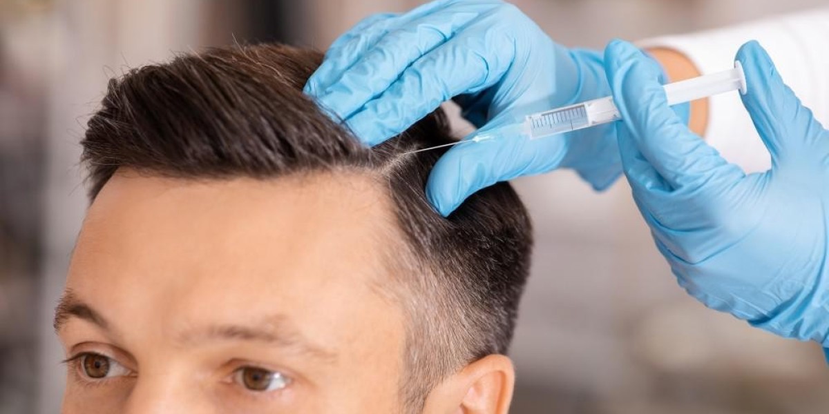Find the Best PRP Hair Specialists in Riyadh for Optimal Results