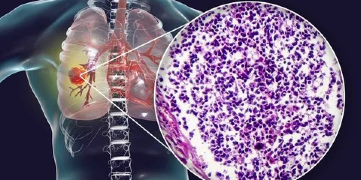 Lorlatinib Market Growth Trends Analysis and Dynamic Demand, Forecast 2024 to 2034
