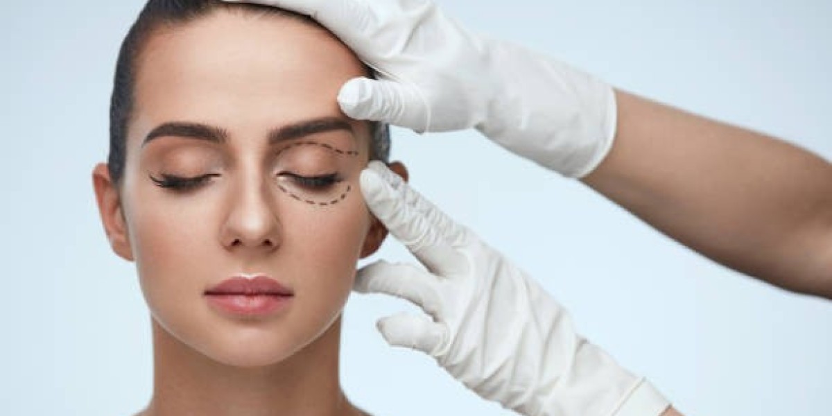 Perfect Your Eye Contour: Choose The Best Eyelid Surgery Doctor in Riyadh