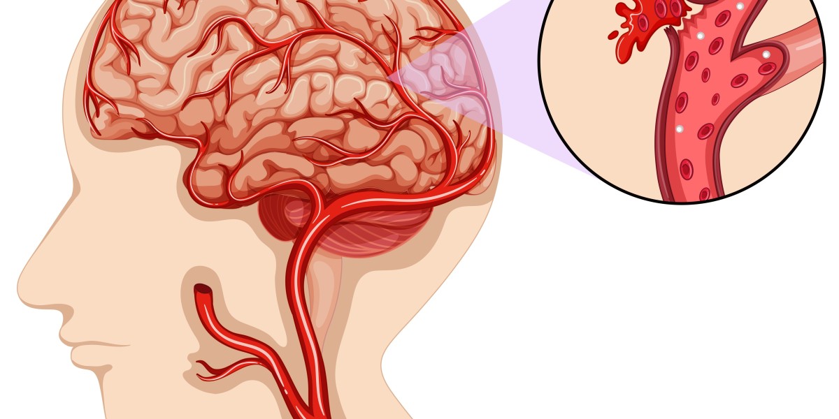 BioScan Research: Advanced Solutions for Intracranial Hemorrhage Detection
